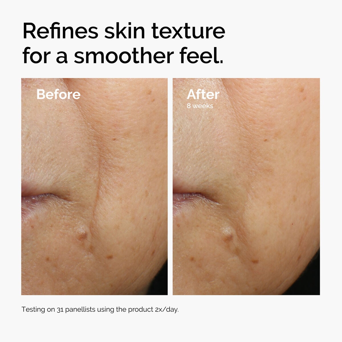 Caffeine + Escin Face Serum Targeted Serum Care V2