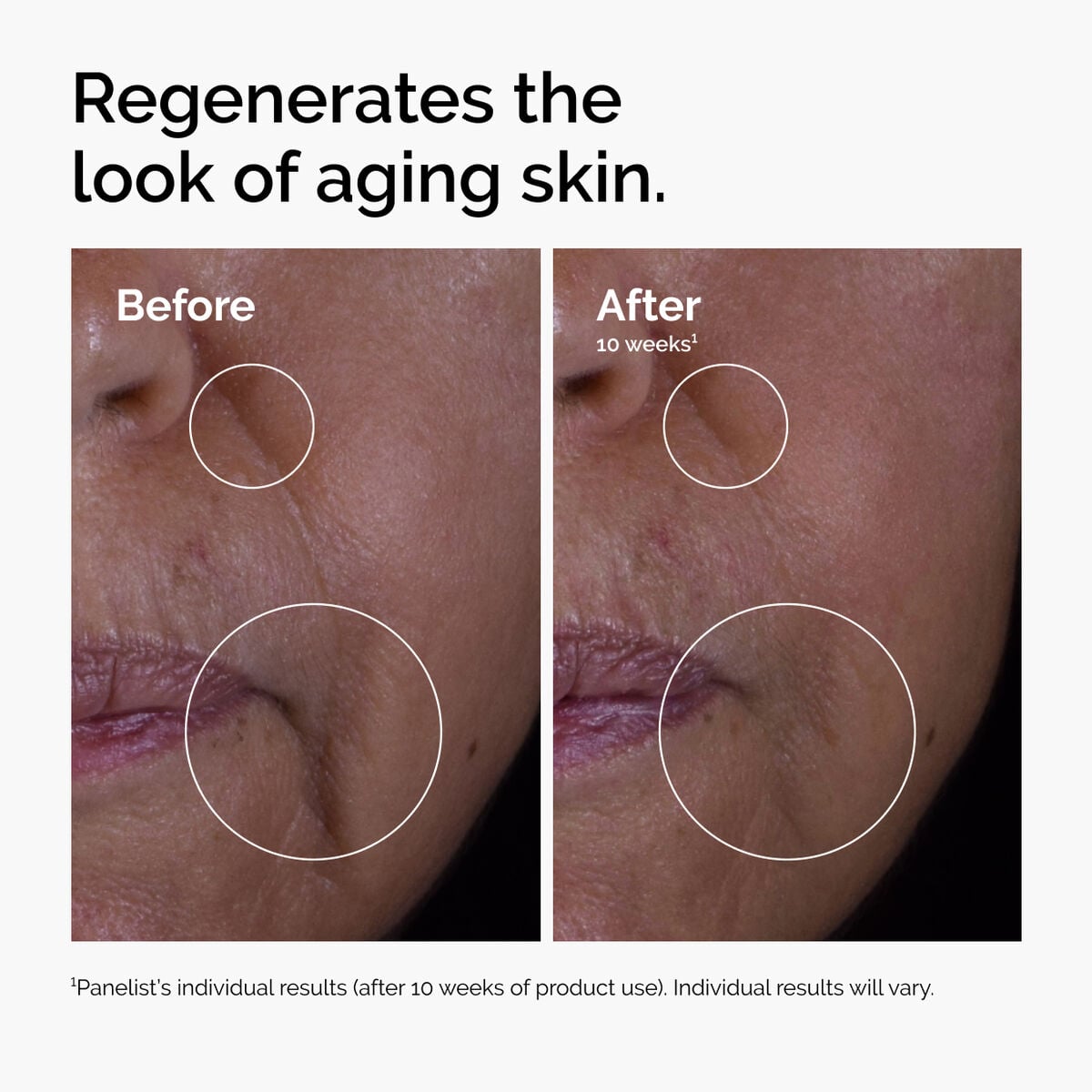 GF Solution Targeted Serum Care R2