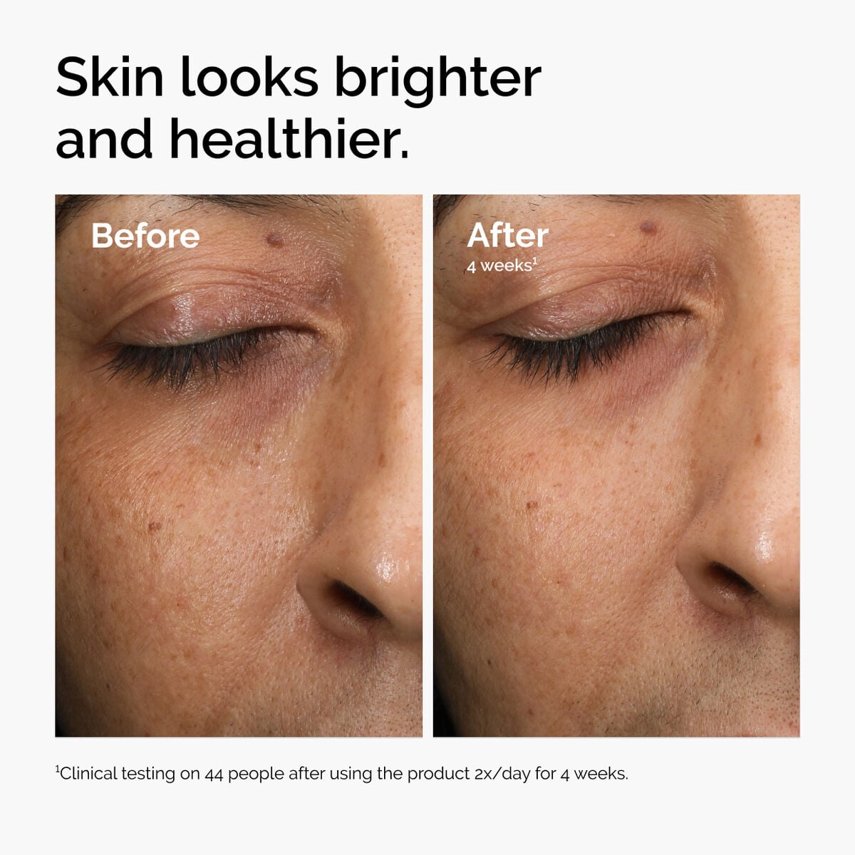 Multi-Antioxidant Radiance Serum Targeted Serum Care