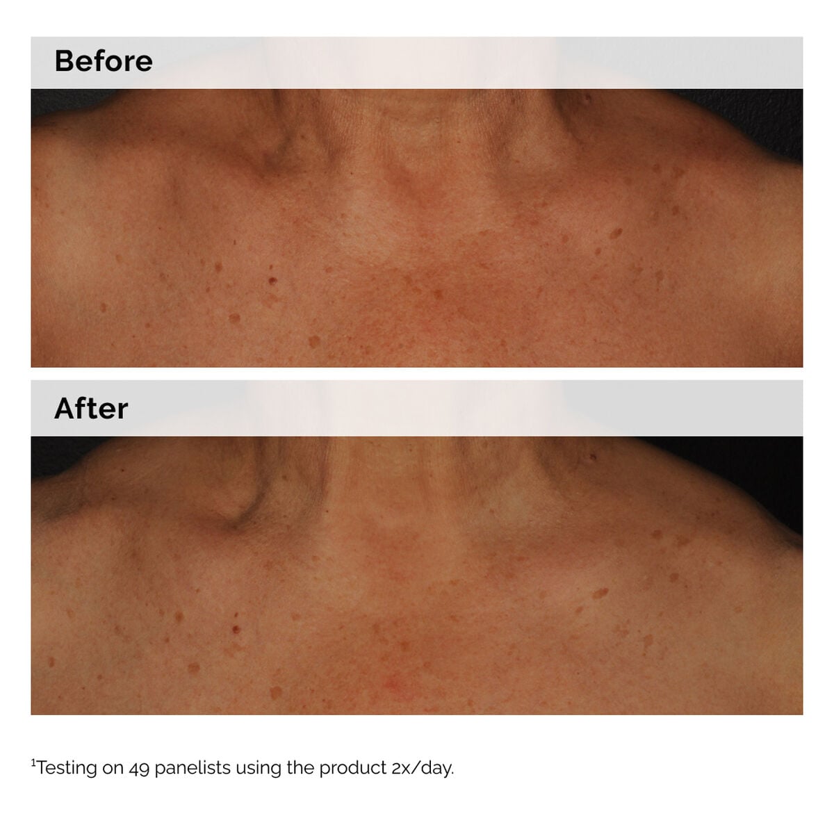 Niacinamide 5% Face and Body Emulsion Targeted Serum Care
