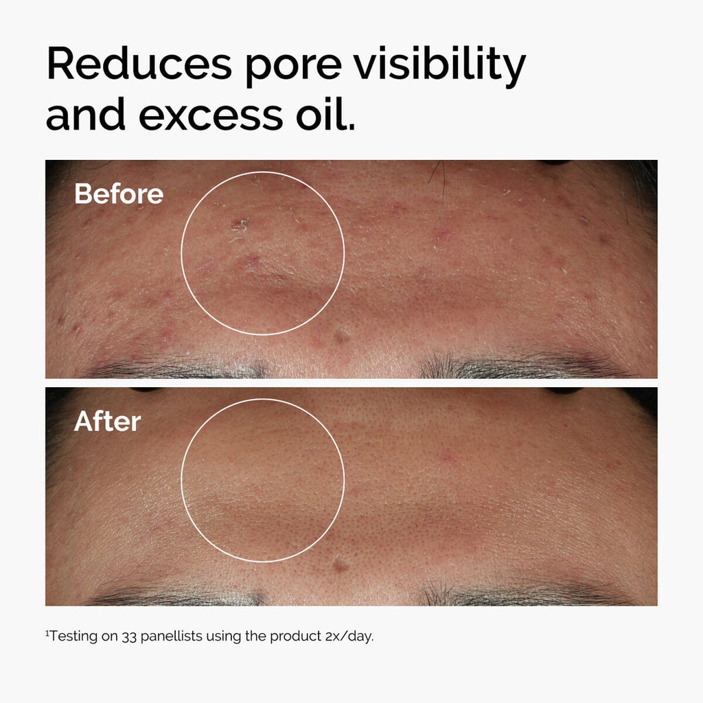 Niacinamide + Zinc Targeted Serum Care Q5