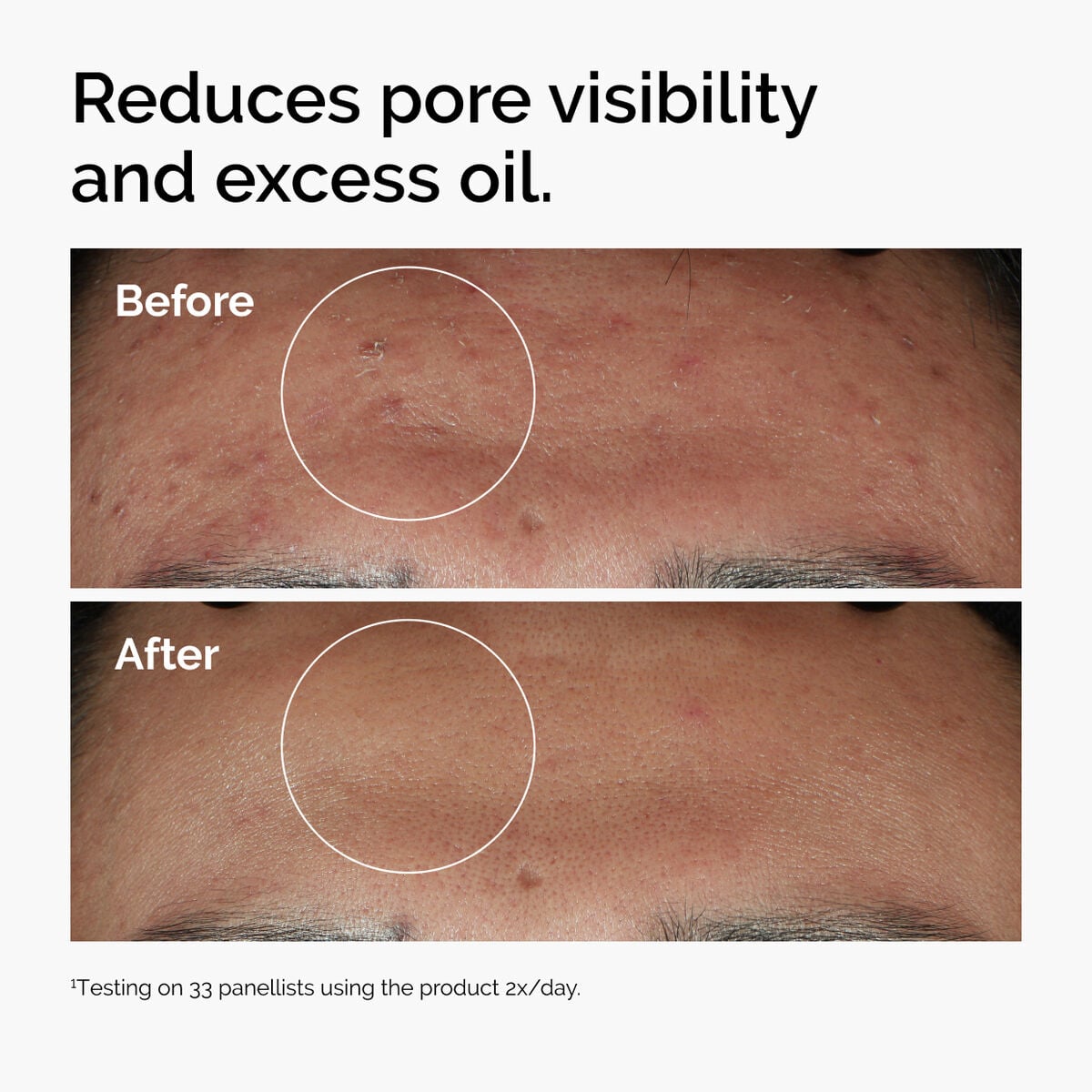 Niacinamide + Zinc Targeted Serum Care Q5