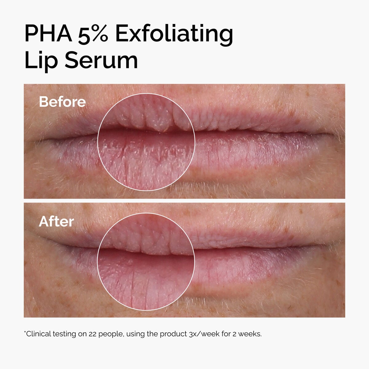PHA Exfoliating Lip Serum Daily Treatment Ritual E7