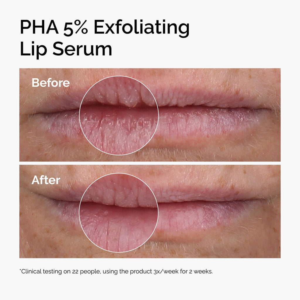 PHA Exfoliating Lip Serum Targeted Serum Care B9