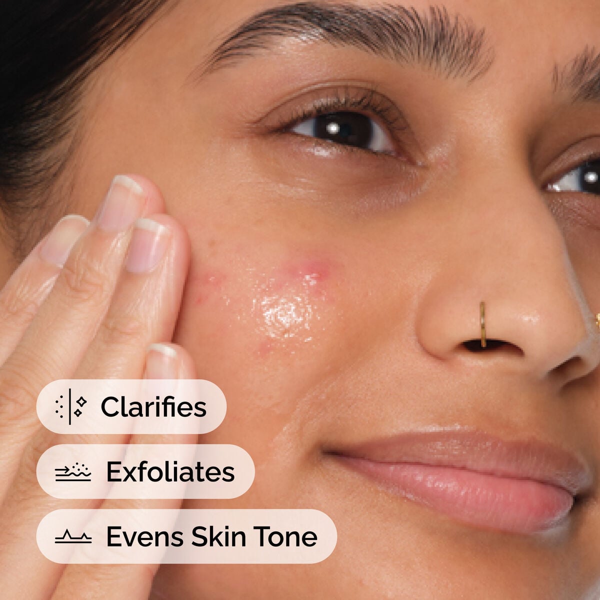 Salicylic Acid Anhydrous Solution Targeted Serum Care N7