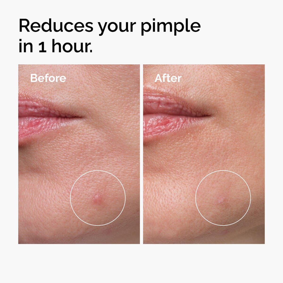 Sulfur Powder-to-Cream Concentrate Targeted Serum Care O4